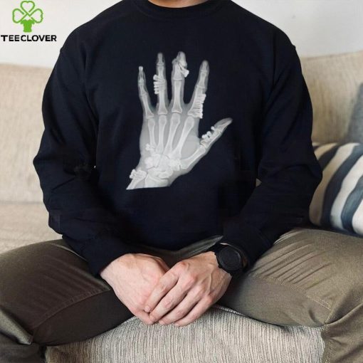 Eduardo Valdes Hevia hand teeth Xray hoodie, sweater, longsleeve, shirt v-neck, t-shirt