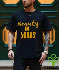 Original beauty In Scars Shirt