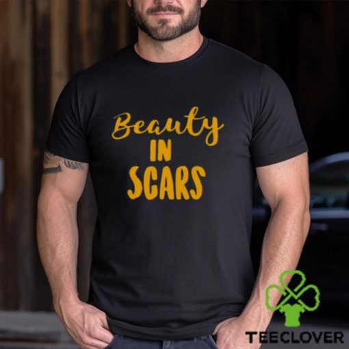 Original beauty In Scars Shirt