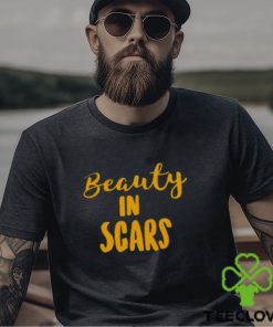 Original beauty In Scars Shirt