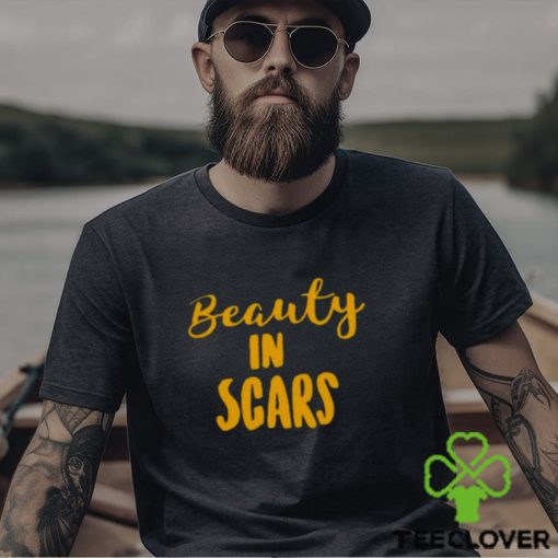 Original beauty In Scars Shirt