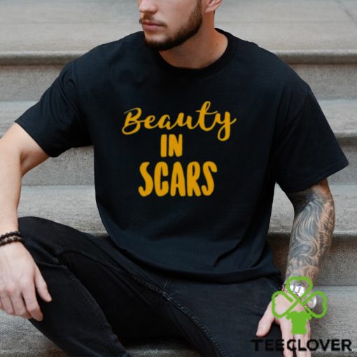 Original beauty In Scars Shirt